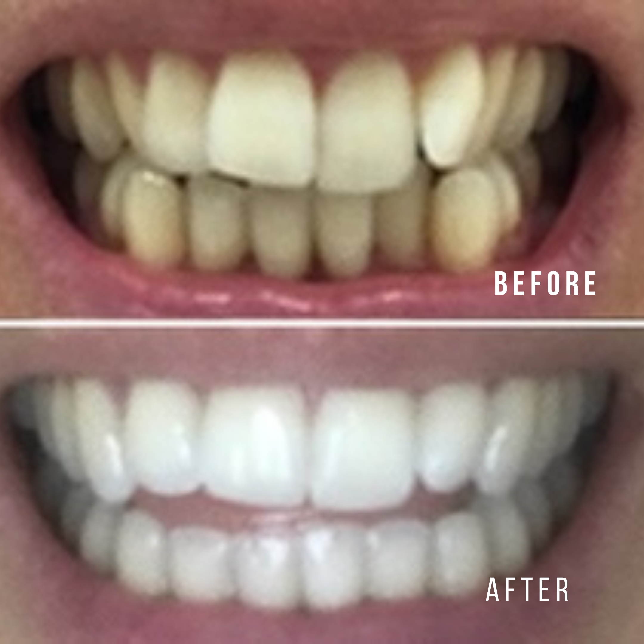 Before and After Transformation